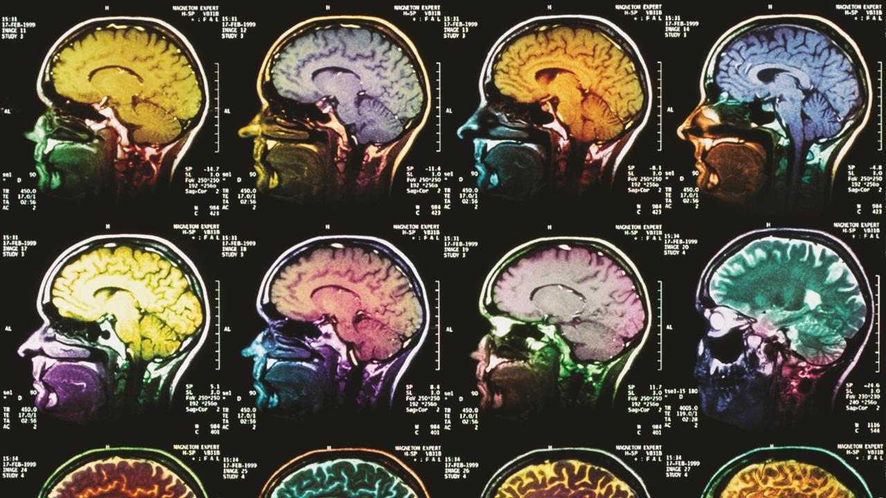 Brain Imaging Studies Seek Signs Of >> New Mri Contrast Agents Feature Chemistry World Brain Imaging Studies Seek Signs Of >> New Mri Contrast Agents Feature Chemistry World